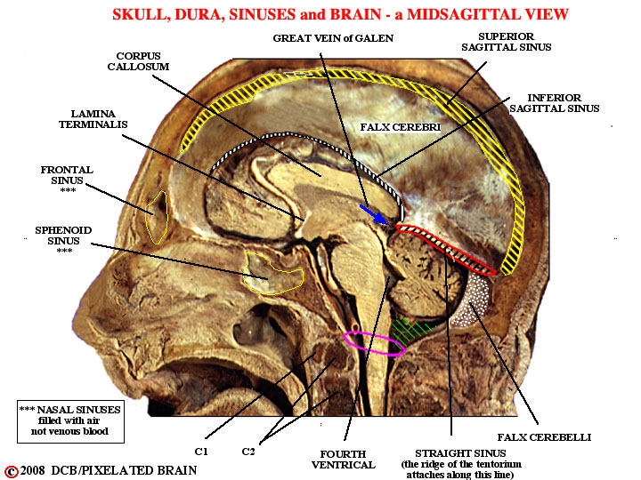 skull, falx cerebri, venous sinuses, and brain - a midsagittal view 