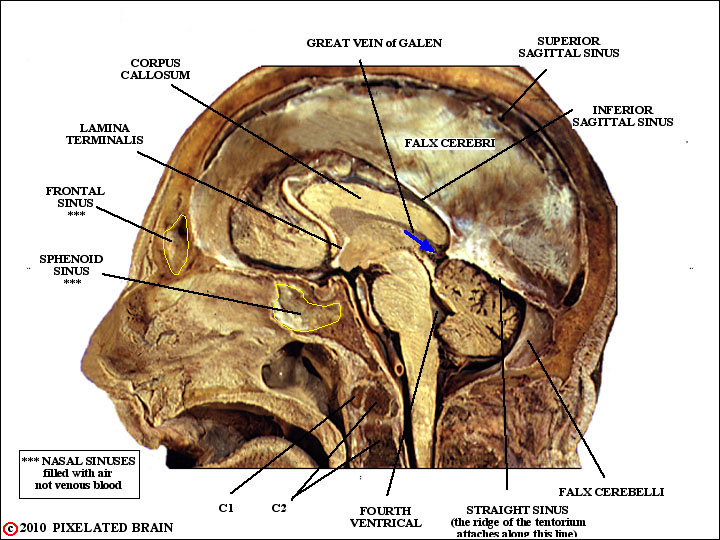 skull, falx cerebri, venous sinuses, and brain - a midsagittal view 