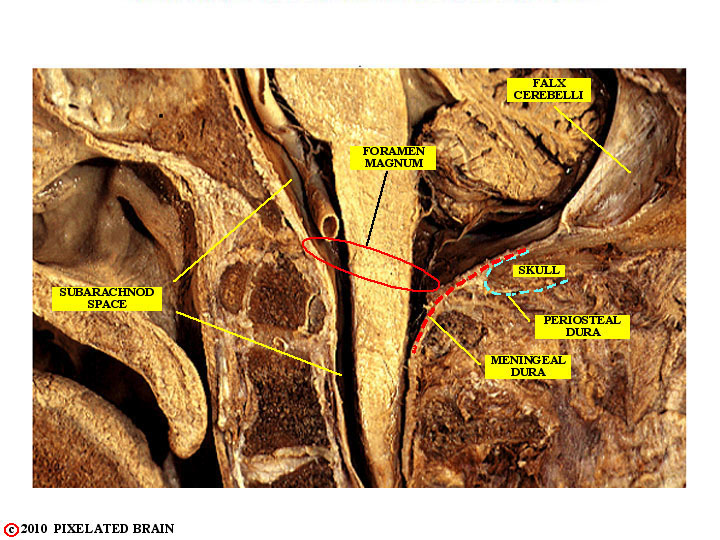 skull, dura and brainstem - a midsagittal view 