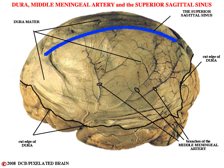 dura, middle meningeal artery and superior sagittal sinus 