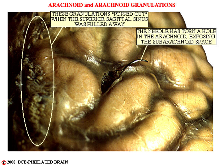 arachnoid, arachnoid granulations and the subarachnoid space 