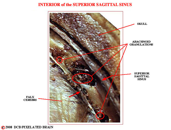 arachnoid granulations within the superior sagittal sinus 