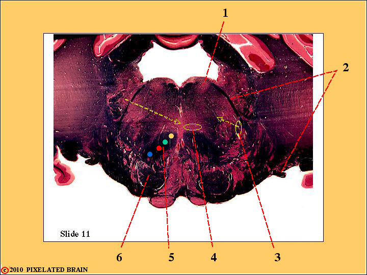 CrossSection through the Caudal Pons