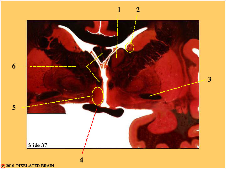  Slide 37 - the anterior pole of the Diencephalon 