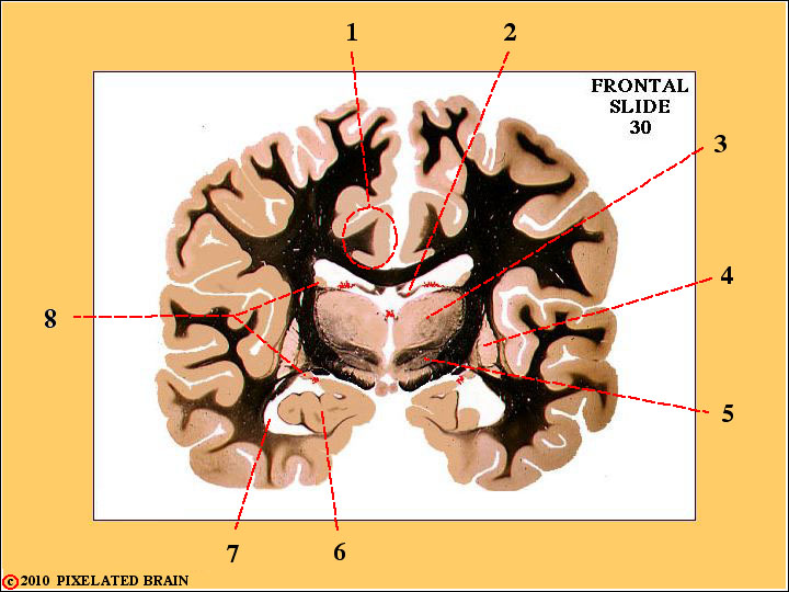 a frontal section through the Diencephalon 