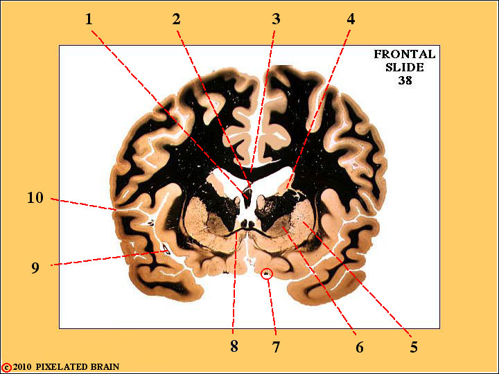  a frontal section through the Basal Ganglia 
