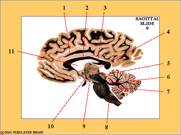  a parasagittal view of the Brain 